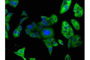 Immunofluorescence staining of HepG2 cells with ABIN7164832 at 1:166, counter-stained with DAPI. (PCSK9 anticorps  (AA 153-380))