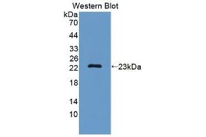 Detection of Recombinant SF3B3, Mouse using Polyclonal Antibody to Splicing Factor 3B Subunit 3 (SF3B3) (SF3B3 anticorps  (AA 35-210))