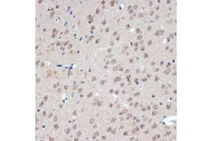 Immunohistochemistry of paraffin-embedded mouse brain using XPD/ERCC2 Rabbit mAb (ABIN7267057) at dilution of 1:100 (40x lens).