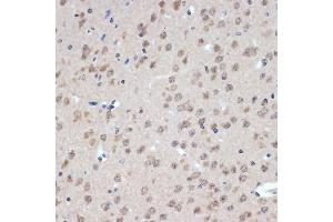 Immunohistochemistry of paraffin-embedded mouse brain using XPD/ERCC2 Rabbit mAb (ABIN7267057) at dilution of 1:100 (40x lens). (ERCC2 anticorps)