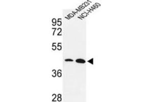 Western Blotting (WB) image for anti-Kruppel-Like Factor 4 (Gut) (KLF4) antibody (ABIN3001588) (KLF4 anticorps)