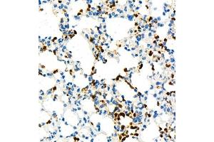 Immunohistochemistry of paraffin embedded mouse lung+LPS using ly6g (ABIN7074524) at dilution of 1:1000 (400x lens) (Ly6g anticorps)