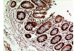 Immunohistochemistry (IHC) analysis of paraffin-embedded Human Colon, antibody was diluted at 1:100. (HLA-DQ1/DQ2 anticorps  (Internal Region))