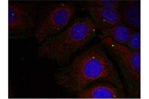 Image no. 1 for anti-Synuclein, alpha (SNCA) (pTyr125) antibody (ABIN401546) (SNCA anticorps  (pTyr125))