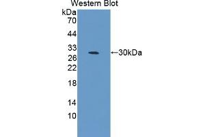Detection of Recombinant CELSR3, Mouse using Polyclonal Antibody to Cadherin EGF LAG Seven Pass G-Type Receptor 3 (CELSR3)
