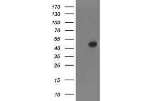 Western Blotting (WB) image for anti-SET Domain Containing (Lysine Methyltransferase) 7 (SETD7) antibody (ABIN1500903) (SETD7 anticorps)