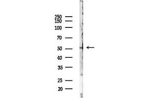 Western blot analysis of lysates from  cells(heat-shock,45 min treatment), using GABAA R alpha1 Antibody at 1/1000 dilution.