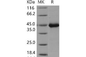 Western Blotting (WB) image for WNT Inhibitory Factor 1 (WIF1) protein (His tag) (ABIN7320086)