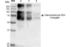 Western blot analysis showing detection of 67 kDa Malondialdehyde BSA Conjugate (ABIN5564152, ABIN5564153 and ABIN5564154) using Anti-Malondialdehyde Antibody, Clone 6H6 (SMC-514). (Malondialdehyde Protein (MDA) (BSA))