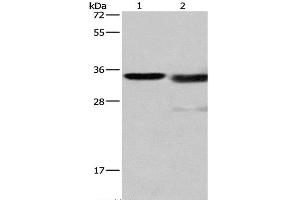 Western Blot analysis of Mouse kidney tissue and A172 cell using Cathepsin L Polyclonal Antibody at dilution of 1:900 (Cathepsin L anticorps)