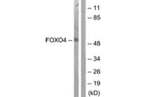 Western blot analysis of extracts from K562 cells, using FOXO4 (Ab-451) Antibody. (FOXO4 anticorps  (AA 417-466))