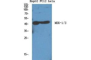 Western Blot (WB) analysis of specific cells using MEK-1/2 Polyclonal Antibody. (MEK1/2 anticorps  (Ser112))