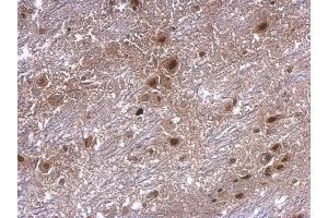 IHC-P Image axin 2 antibody [N2C2], Internal detects axin 2 protein at cytosol on mouse hind brain by immunohistochemical analysis.