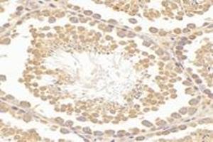 Immunohistochemistry analysis of paraffin-embedded mouse testis using,RHOBTB3 (ABIN7075422) at dilution of 1: 3600 (RHOBTB3 anticorps)