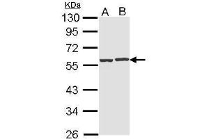 WB Image Sample (30 ug of whole cell lysate) A: Hep G2 , B: Raji 10% SDS PAGE antibody diluted at 1:1000 (CAP1 anticorps  (Center))