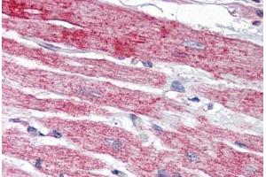 Human Heart (formalin-fixed, paraffin-embedded) stained with NPTX2 antibody ABIN343900 at 5 ug/ml followed by biotinylated goat anti-rabbit IgG secondary antibody ABIN481713, alkaline phosphatase-streptavidin and chromogen. (NPTX2 anticorps  (Internal Region))