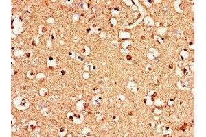 Immunohistochemistry of paraffin-embedded human brain tissue using ABIN7159432 at dilution of 1:100 (Metabotropic Glutamate Receptor 1 anticorps  (AA 880-1017))
