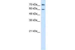 Western Blotting (WB) image for anti-Proline Dehydrogenase (Oxidase) 2 (PRODH2) antibody (ABIN2462440) (PRODH2 anticorps)