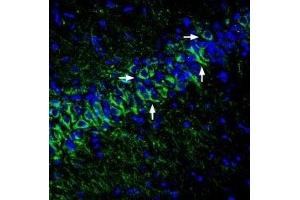 Expression of KCNK12  in rat hippocampusImmunohistochemical staining of perfusion-fixed frozen rat brain sections with Anti-KCNK12  (extracellular) Antibody (ABIN7043449, ABIN7045070 and ABIN7045071), (1:400), followed by goat anti-rabbit-AlexaFluor-488 secondary antibody. (Potassium Channel, Subfamily K, Member 12 (KCNK12) Peptide)