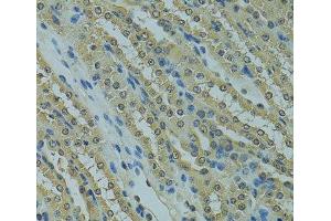 Immunohistochemistry of paraffin-embedded Mouse kidney using UBE2I Polyclonal Antibody at dilution of 1:100 (40x lens).