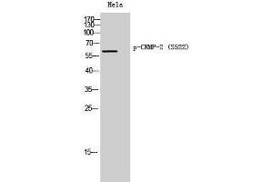 Western Blotting (WB) image for anti-Dihydropyrimidinase-Like 2 (DPYSL2) (pSer522) antibody (ABIN3173158) (DPYSL2 anticorps  (pSer522))