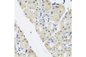 Immunohistochemistry of paraffin-embedded human stomach using ALAD antibody (ABIN5974581) at dilution of 1/100 (40x lens). (ALAD anticorps)