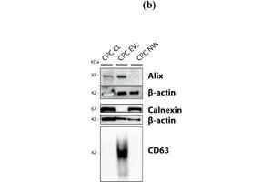 Comparative analysis of CPC-EVs and CPC-NVs characteristics and production process.