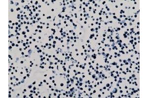 ICC staining of human HepG2 cells with recombinant H3K79me2 antibody.