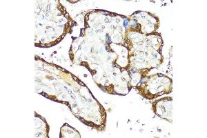Immunohistochemistry of paraffin-embedded Human placenta using IFN antibody (ABIN3015562, ABIN3015563, ABIN3015564 and ABIN6218872) at dilution of 1:100 (40x lens). (IFNAR2 anticorps  (AA 27-243))