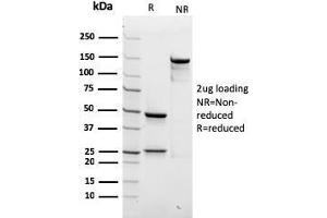 SDS-PAGE Analysis Purified SPTBN2 Recombinant Mouse Monoclonal Antibody (rSPTBN2/1778). (Recombinant Spectrin, Beta, Non-erythrocytic 2 (SPTBN2) (AA 356-475) anticorps)