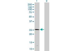 Western Blot analysis of PLA2G4D expression in transfected 293T cell line by PLA2G4D MaxPab polyclonal antibody. (PLA2G4D anticorps  (AA 1-216))