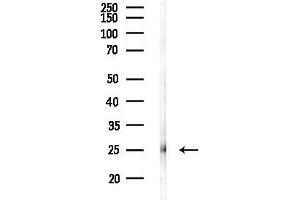 anti-Eukaryotic Translation Elongation Factor 1 beta 2 (EEF1B2) (Internal Region) antibody