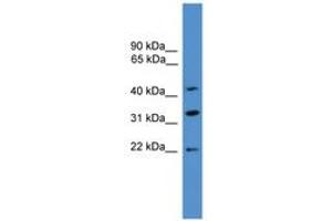 Image no. 1 for anti-ADP-Ribosylation Factor Interacting Protein 1 (ARFIP1) (C-Term) antibody (ABIN6746382) (ARFIP1 anticorps  (C-Term))