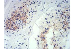 Immunohistochemical analysis of paraffin-embedded testis tissues using ATG14L mouse mAb with DAB staining.
