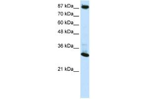 WB Suggested Anti-CTCF Antibody Titration:  0. (CTCF anticorps  (N-Term))