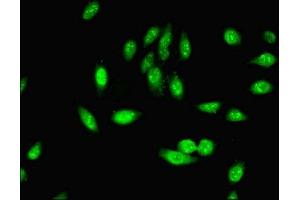 Immunofluorescent analysis of Hela cells using ABIN7163064 at dilution of 1:100 and Alexa Fluor 488-congugated AffiniPure Goat Anti-Rabbit IgG(H+L)