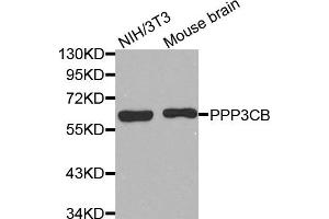 Western Blotting (WB) image for anti-Protein Phosphatase 3, Catalytic Subunit, beta Isozyme (PPP3CB) antibody (ABIN1874234) (PPP3CB anticorps)