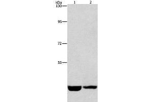 Western Blot analysis of Hela and A431 cell using CSNK1E Polyclonal Antibody at dilution of 1:1550 (CK1 epsilon anticorps)