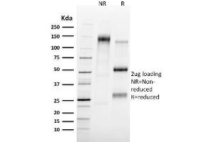 SDS-PAGE Analysis Purified Tal1 Mouse Monoclonal Antibody (TAL1/2707). (TAL1 anticorps)