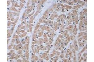 Immunohistochemical staining of formalin-fixed paraffin-embedded human heart showing staining with ADRA1B polyclonal antibody  at 1:100 dilution. (ADRA1B anticorps)