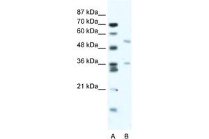 Western Blotting (WB) image for anti-BTB (POZ) Domain Containing 3 (BTBD3) antibody (ABIN2461041) (BTBD3 anticorps)