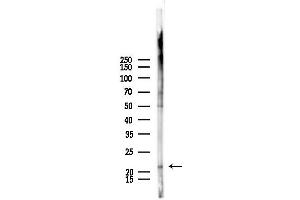 anti-RAB10, Member RAS Oncogene Family (RAB10) (C-Term) antibody