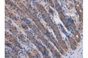 Detection of TNFa in Rat Stomach Tissue using Monoclonal Antibody to Tumor Necrosis Factor Alpha (TNFa) (TNF alpha anticorps  (AA 80-235))