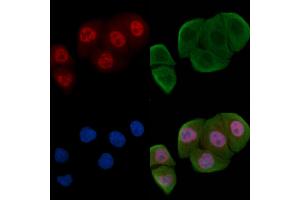 ABIN6256258 and ABIN6267588 staining Hela cells(30 min of UV treatment) by IF/ICC. (RUNX1 anticorps  (pSer304))