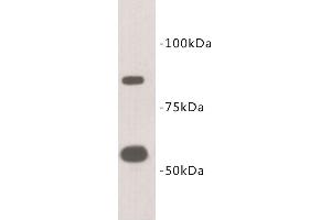 Western Blotting (WB) image for anti-Transmembrane Protein 2 (TMEM2) antibody (ABIN1854991) (TMEM2 anticorps)