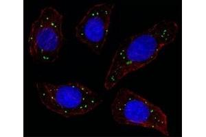 Fluorescent image of U251 cell stained with MERTK antibody at 1:25. (MERTK anticorps)
