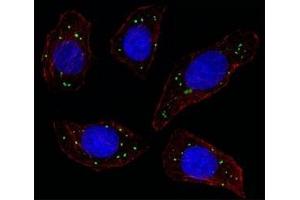Fluorescent image of U251 cell stained with MERTK antibody at 1:25.