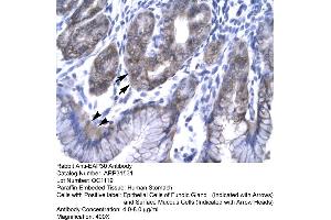 Rabbit Anti-EAP30 Antibody  Paraffin Embedded Tissue: Human Stomach Cellular Data: Epithelial cells of Fundic Gland and Surface Mucous Cells Antibody Concentration: 4.