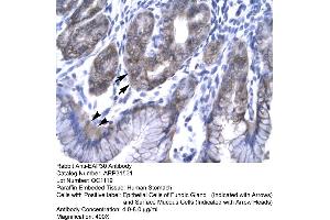 Rabbit Anti-EAP30 Antibody  Paraffin Embedded Tissue: Human Stomach Cellular Data: Epithelial cells of Fundic Gland and Surface Mucous Cells Antibody Concentration: 4. (SNF8 anticorps  (N-Term))