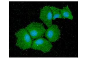 ICC/IF analysis of QPRT in Hep3B cells line, stained with DAPI (Blue) for nucleus staining and monoclonal anti-human QPRT antibody (1:100) with goat anti-mouse IgG-Alexa fluor 488 conjugate (Green).